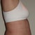 After (day 10 post-op)
