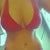 P.O. Day 22 - After tanning bed :)