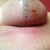 PO Day 10-My attempt to capture my boob incisions. I was glad they didn't have to cut around my areola. My breasts have not bothered me at all so far. Knock on wood!