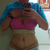 3 weeks post op