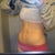 5 weeks post op, look at those abs!