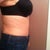 8 1/2 weeks post op side view