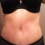 8 1/2 weeks post op panties