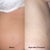 Doctor took picture of belly before and this was right after procedure, very flat