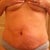 Frontal view of the yucky tummy