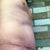 6 months post-op