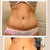 Revisiting Scar therapy. I think there is a noticeable difference. This is less than 2 weeks of therapy.