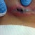 The holes look like a pig snout!