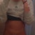 9 day post op