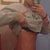 9 day post op