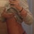 9 day post op