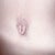 14 weeks 2 days PO