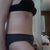 Side view 3.5 weeks PostOp.  Still very bloated and swollen between belly button and pubic area.