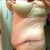 Left side. I know the scars are rough on me but I don't really stress over them. They will fade.