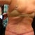 My "whale tail" as my hubby calls it. The numbness is getting a little better.