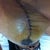 Left Breast (Now all of the pics are posting upside down SMH)