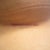 Incision - looking really good (I think).  :)