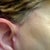 taken Mar 19 2011 no makeup 2 inches away from ears right ear.11 months after