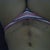 scar at 9day.. sorry i use hp camera not so clear