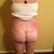 Post Op 15 - back