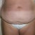 befor front