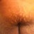 Soooo many stretch marks.