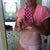4.5 months post op