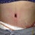 Belly button
