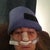 Day two. Icing my head.