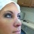 Day seven. Removed stitches and brace, put on the tape. Nose is still very swollen