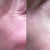 Before and after, you can see my skin was smooth before and "textured" after.