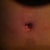 Belly button healing (I hope)