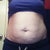 Before. Front view. A little bloated due to the fact that I am on my period