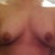 Im kinda squishing them down but this shows my "deformity".