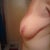 Side Before 36DDD/E/F)??