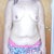 before surgery after 70 pound weight loss