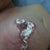 burst areola with cream on 6 weeks post op