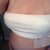 one day post op