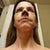 Lower view 1 week postop. Bruises are fading!  At one point I was bruised eyebrows to collarbone.