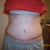 Day 26 Post Op