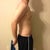 One day after Smart lipo.