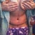 This is me one day post op. Not standing straight since its too tight still
