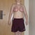 five weeks post op