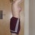 five weeks post op