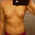Before. That nonsense I first said about keeping this breast size, if i could just loose my excess weight...ha! What was I thinking, clearly pre-surgery crazy talk!
