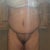 19 days post op