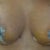 2 weeks post