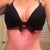 4 weeks post op