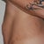 Side view pre op