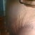 right side scar is looking awesome
